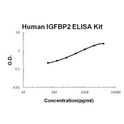 Human IGFBP2 ELISA Kit EZ-Set™ (DIY Antibody Pairs) Boster Bio