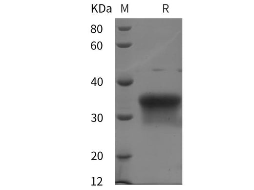 SDS-PAGE analysis of Human Oncostatin M/OSM proteins, 2 μg/lane of Recombinant Human Oncostatin M/OSM proteins was resolved with SDS-PAGE under reducing conditions, showing bands at 35 kDa.