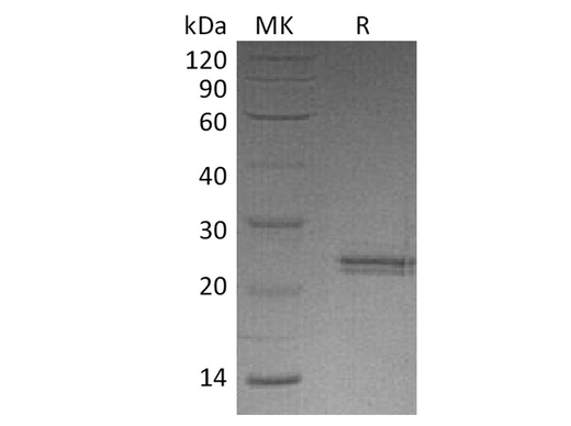 Recombinant Human CNTF Protein - ABMIUM