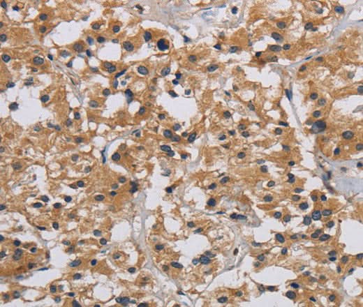 Anti-Human/Mouse/Rat INPPL1 Antibody - ABMIUM