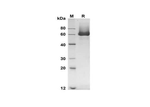 SDS-PAGE analysis of Mouse Mmp8 proteins, 2 μg/lane of Recombinant Mouse Mmp8 proteins was resolved with SDS-PAGE under reducing conditions, showing bands at 60 kDa.