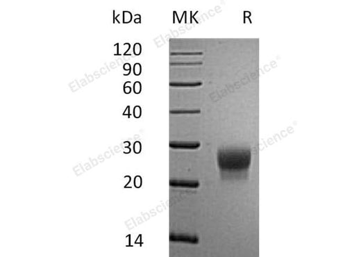 Recombinant Mouse G-CSF/CSF3 Protein (His Tag) - ABMIUM