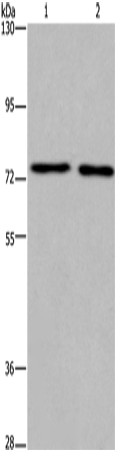 Anti-Human/Mouse KCNQ4 Antibody - ABMIUM
