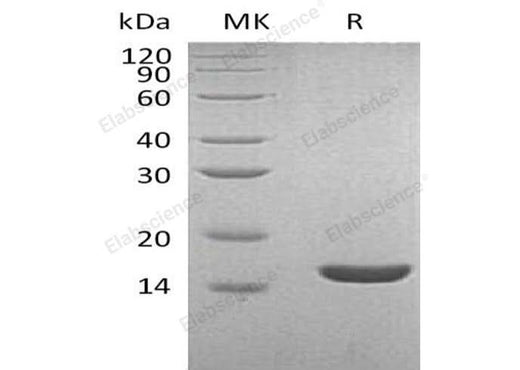 Recombinant Human Lysozyme C/LYZ Protein (His Tag) - ABMIUM