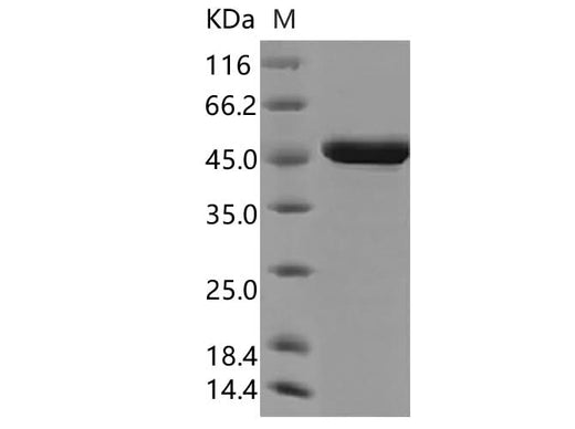 Recombinant SARS-CoV-2 Nucleocapsid Protein (N-His Tag)(Omicron) - ABMIUM