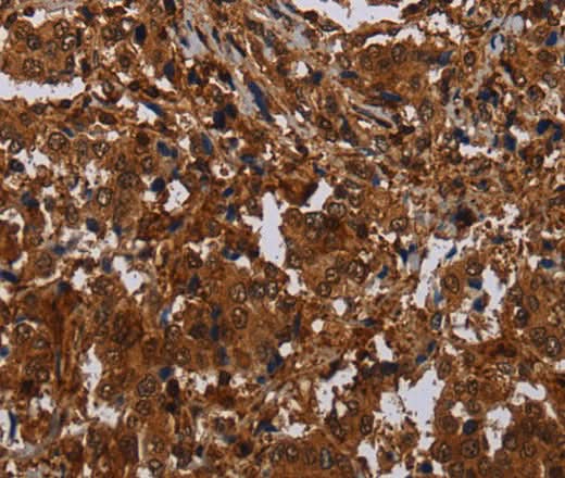 Anti-Human MAGEB18 Antibody - ABMIUM
