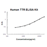 Human Transthyretin/TTR ELISA Kit EZ-Set™ (DIY Antibody Pairs) Boster Bio