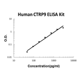 Human CTRP9 EZ-Set™ ELISA Kit (DIY Antibody Pairs) Boster Bio