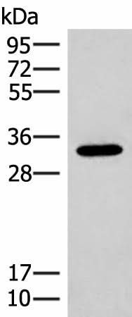 Western blot analysis of Mouse liver tissue lysate using RGR Polyclonal Antibody at dilution of 1:300