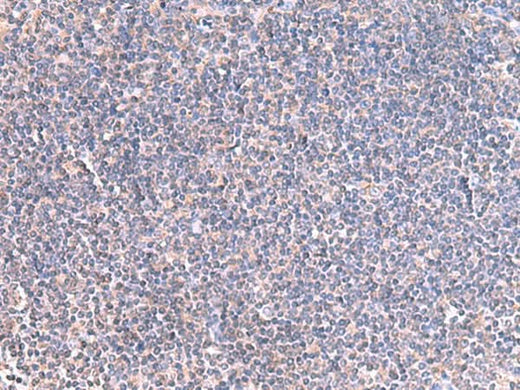Immunohistochemistry of paraffin-embedded Human tonsil tissue using GRIA2 Polyclonal Antibody at dilution of 1:40(×200)