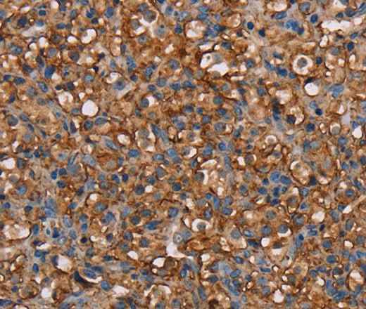 Anti-Human/Mouse NEDD4L Antibody