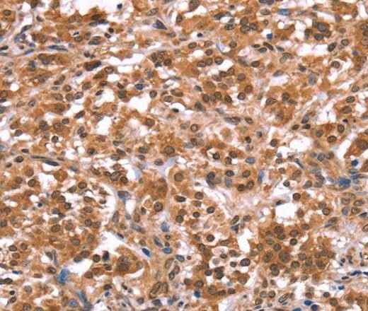 Anti-Human/Mouse AMER1 Antibody - ABMIUM