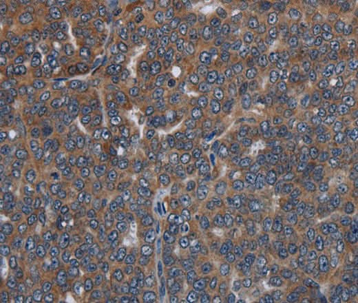 Anti-Human LETMD1 Antibody - ABMIUM