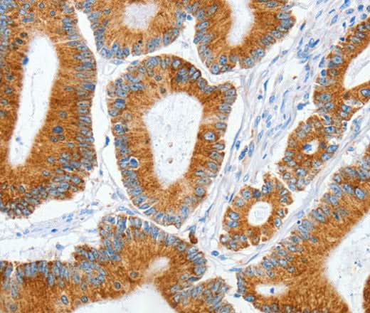 Anti-Human/Mouse/Rat MANF Antibody - ABMIUM