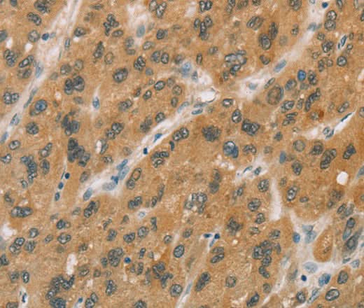 Anti-Human CYP11A1 Antibody - ABMIUM