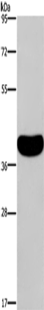 Anti-Human CRELD2 Antibody - ABMIUM