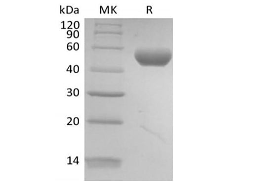 Recombinant Human PVRL2/Nectin-2/CD112 (C-6His-Avi) Biotinylated - ABMIUM