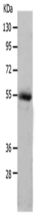 Anti-Human MMP17 Antibody - ABMIUM