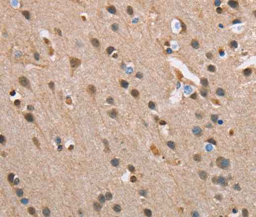 Anti-Human SERPINA1 Antibody