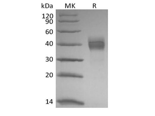Recombinant Rhesus Macaque Tumor-associated Calcium Signal Transducer 2/TROP-2 (C-6His) - ABMIUM