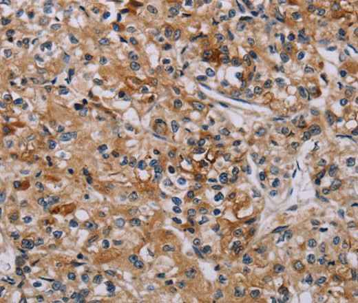 Anti-Human/Mouse AATK Antibody