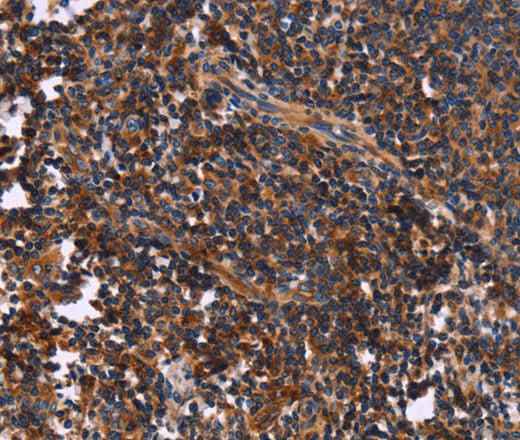 Anti-Human/Mouse/Rat SYT4 Antibody
