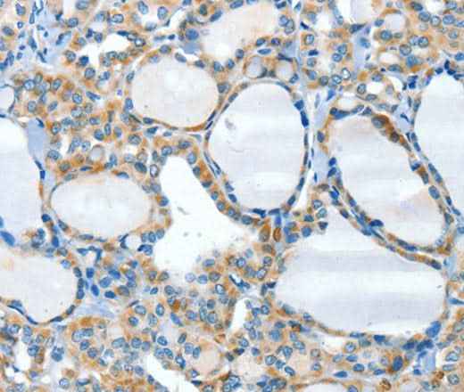 Anti-Human/Mouse HID1 Antibody