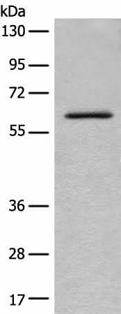 Anti-Human/Mouse ENO4 Antibody - ABMIUM