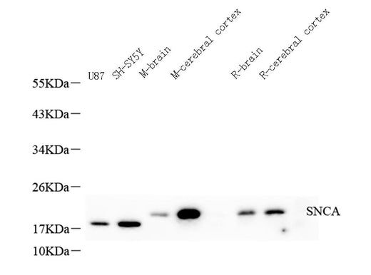Western Blot analysis of various samples using SNCA Polyclonal Antibody at dilution of 1:600.