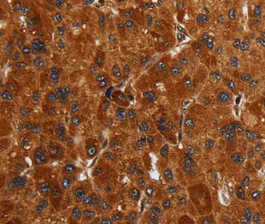 Anti-Human/Mouse ENTPD7 Antibody - ABMIUM
