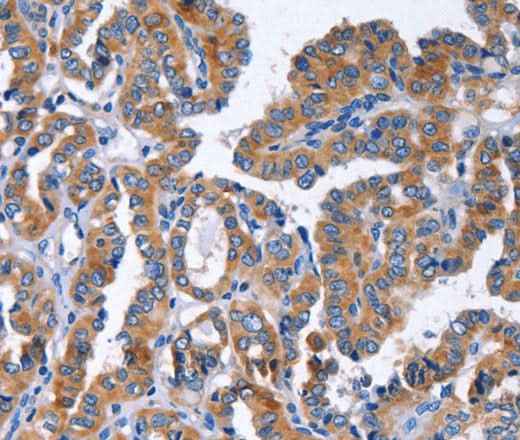 Anti-Human IGSF10 Antibody