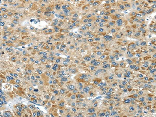 Anti-Human/Mouse USP9X Antibody - ABMIUM