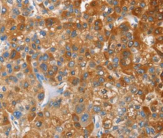 Anti-Human CD200R1 Antibody