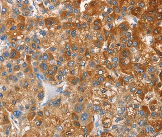 Anti-Human CD200R1 Antibody - ABMIUM
