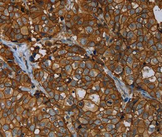 Anti-Human/Mouse/Rat ERBB4 Antibody