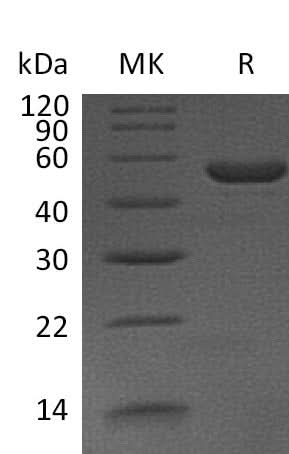 Recombinant Mouse Interleukin-11/IL-11 Protein (Fc Tag) - ABMIUM