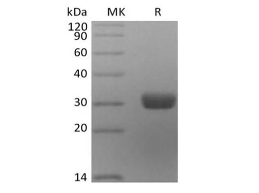 Recombinant Human Angiopoietin-2/ANG2 (C-6His) - ABMIUM