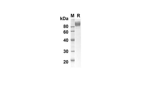 SDS-PAGE analysis of Mouse GPNMB proteins, 2 μg/lane of Recombinant Mouse GPNMB proteins was resolved with SDS-PAGE under reducing conditions, showing bands at 52.6 kDa.