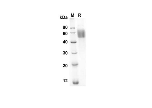 SDS-PAGE analysis of Rat Il1r1 Il1ra proteins, 2 μg/lane of Recombinant Rat Il1r1 Il1ra proteins was resolved with an SDS-PAGE under reducing conditions, showing bands at 34.9 kDa.