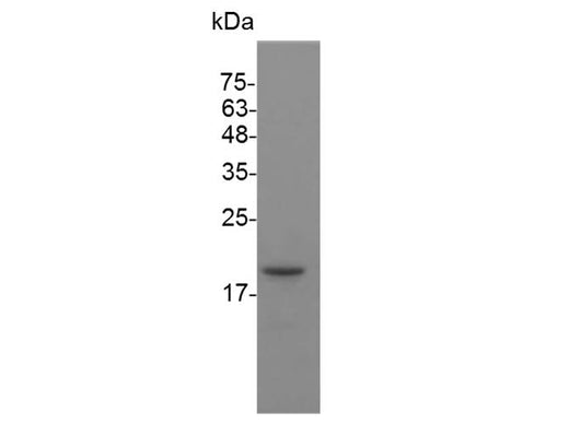 Recombinant Mouse IFN beta 1a protein(His Tag) - ABMIUM