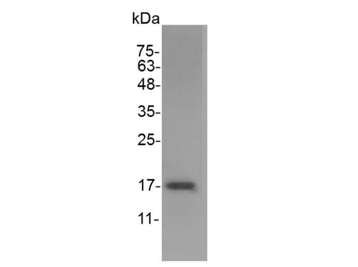 > 98 % as determined by reducing SDS-PAGE.