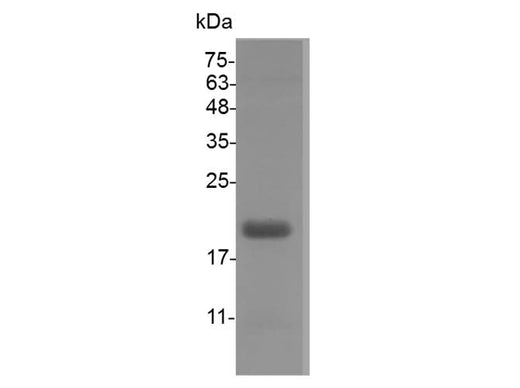 Recombinant Swine IL-1 beta protein(His Tag) - ABMIUM