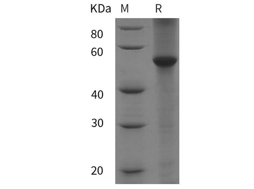 SDS-PAGE analysis of Human PARP8 proteins, 2 μg/lane of Recombinant Human PARP8 proteins was resolved with SDS-PAGE under reducing conditions, showing bands at 55 kDa.