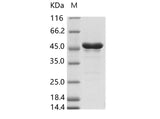 Recombinant ZIKV (strain Zika SPH2015) Envelope protein (aa 291-696, His Tag) - ABMIUM