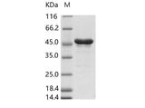 Recombinant ZIKV (strain Zika SPH2015) Envelope protein (aa 291-696, His Tag) - ABMIUM