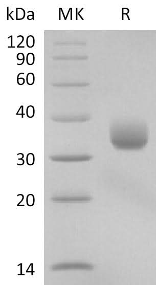 Recombinant SARS-CoV-2 Spike RBD (A435S)(His Tag) - ABMIUM