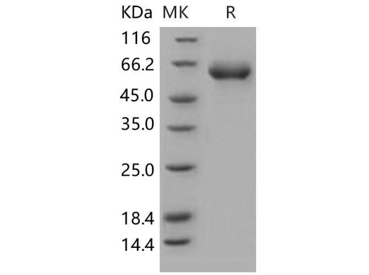 Recombinant Human CD122/IL-2RB Protein (Fc Tag) - ABMIUM