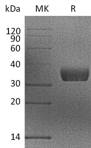 Recombinant Mouse MGL2/CD301b Protein (His Tag) - ABMIUM
