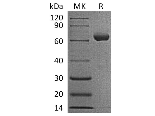 Recombinant Human IGSF11/BTIGSF Protein (Fc Tag) - ABMIUM
