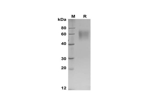 SDS-PAGE analysis of Human IL17RA proteins, 2 μg/lane of Recombinant Human IL17RA proteins was resolved with SDS-PAGE under reducing conditions, showing bands at 50-65 kDa.